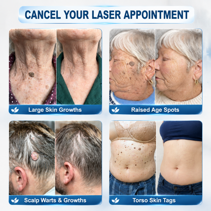 𝐏𝐡𝐚𝐫𝐦𝐚𝐜𝐢𝐬𝐭 𝐑𝐞𝐜𝐨𝐦𝐦𝐞𝐧𝐝𝐞𝐝 🧩𝑯𝗲𝙖𝐥𝒓𝗶𝙯𝗲® 7-𝐷𝑎𝑦 𝗧𝐚𝐠 & 𝗦𝗽𝐨𝐭 𝐄𝐫𝒂𝒔𝒆𝒓🪄(Zero 𝐏𝐚𝐢𝐧, Zero 𝐒𝐜𝐚𝒓𝒔 Rollerball)👩‍⚕️